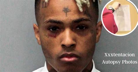 xxxtentacions autopsy photo|Jahseh Onfroy (XXXTentacion) Autopsy Report